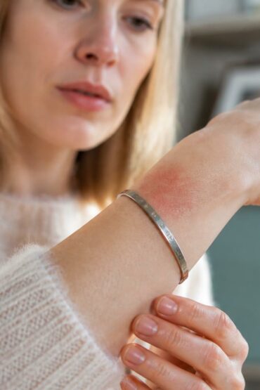 découvrez comment identifier rapidement une réaction allergique liée aux bijoux et protéger votre peau grâce à nos conseils pratiques.