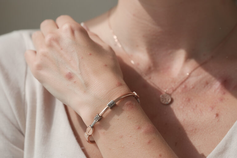 découvrez si les bijoux parfumés sont adaptés aux peaux sensibles, leurs bienfaits, précautions et conseils pour profiter de ces accessoires sans irritation.