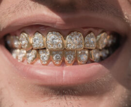 découvrez comment vérifier la qualité et l’authenticité des pierres de vos grillz diamantés grâce à nos conseils d’experts pour un style unique et sécurisé.