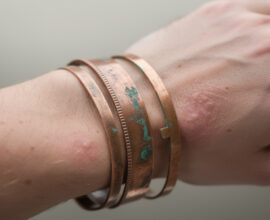 découvrez les risques du vert-de-gris sur vos bijoux en cuivre et ses effets potentiels sur la peau. apprenez à protéger votre santé tout en profitant de vos accessoires.