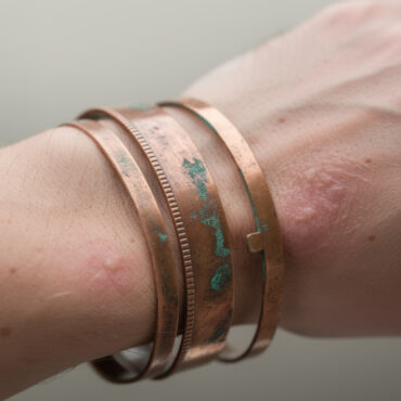 découvrez les risques du vert-de-gris sur vos bijoux en cuivre et ses effets potentiels sur la peau. apprenez à protéger votre santé tout en profitant de vos accessoires.