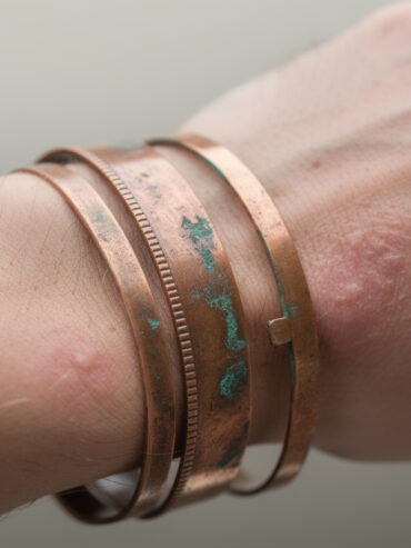 découvrez les risques du vert-de-gris sur vos bijoux en cuivre et ses effets potentiels sur la peau. apprenez à protéger votre santé tout en profitant de vos accessoires.